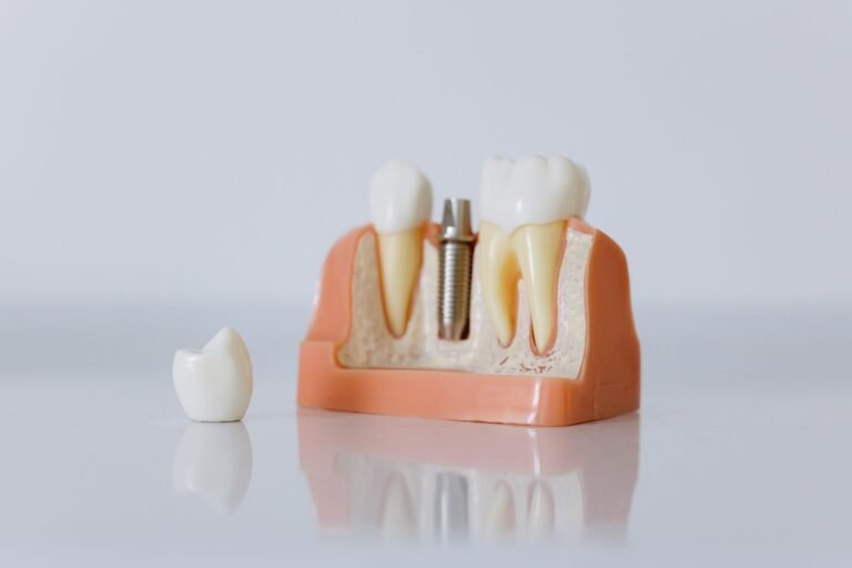 AI Dental Implant Identification: Sharper Than a Dentist?