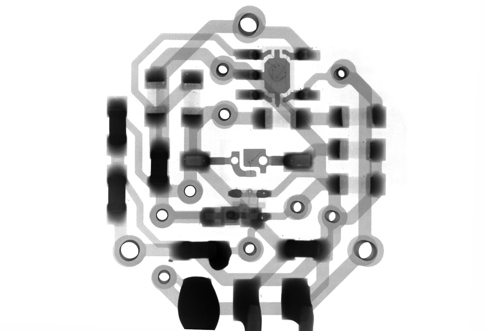 AI Orthodontic Simulation: Real Preview or a Guess? gray and back circuit illustration