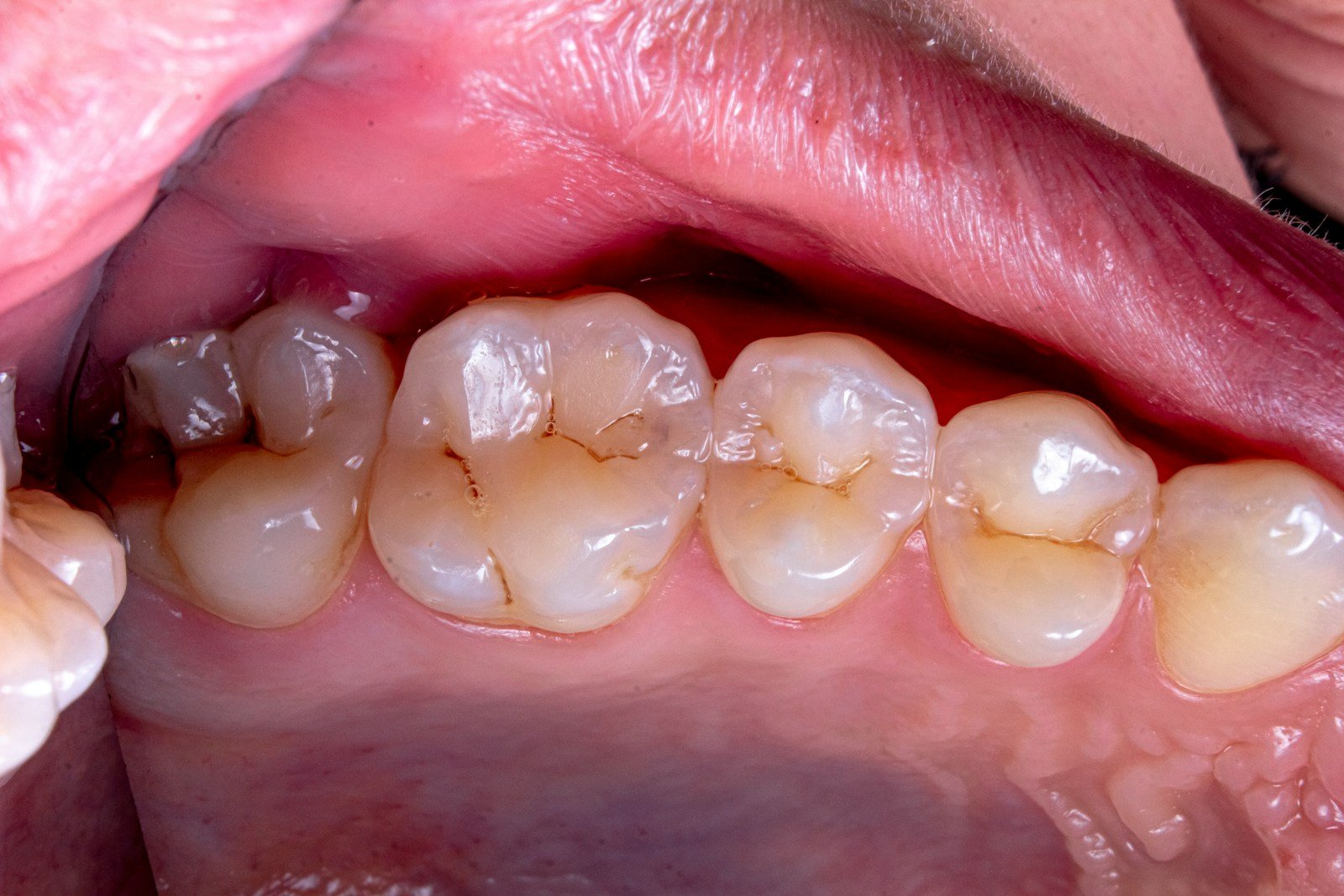 close-up of a person's mouth